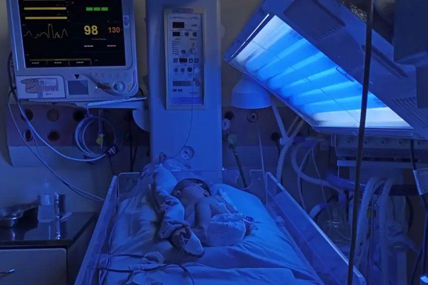 Fototerapia no Hospital da Transamazônica ajuda a salvar recém-nascidos
