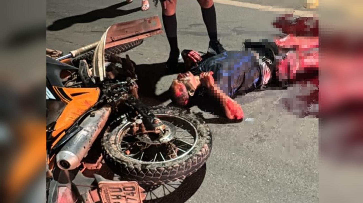 Motociclista perde parte da perna após grave colisão na rodovia Fernando Guilhon