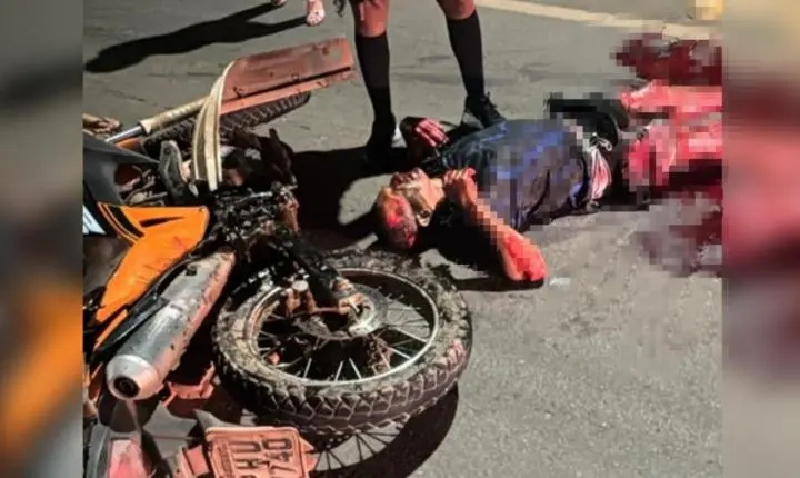 Motociclista perde parte da perna após grave colisão na rodovia Fernando Guilhon