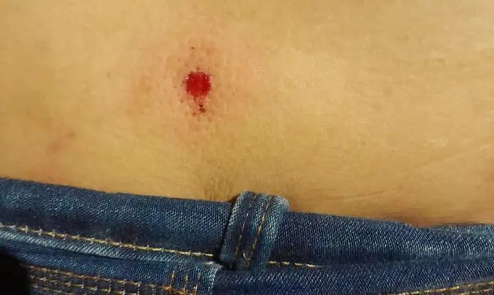 ​Mulheres denunciam ataque com tiros de chumbinho durante carreata de Hana Ghassan em Santarém